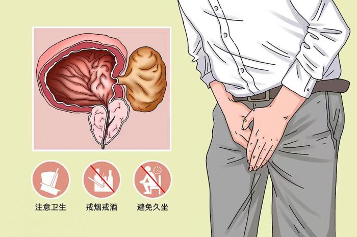 膀胱壁上長“氣球”，看三甲醫(yī)院如何拿捏1 (4).jpg