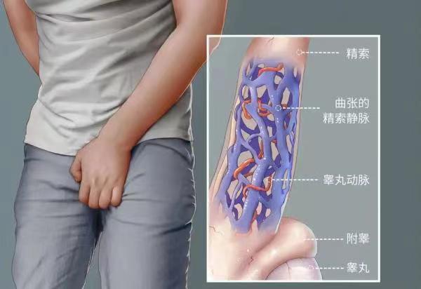 “鏡”顯神通，讓男性健康“殺手”無(wú)處遁形